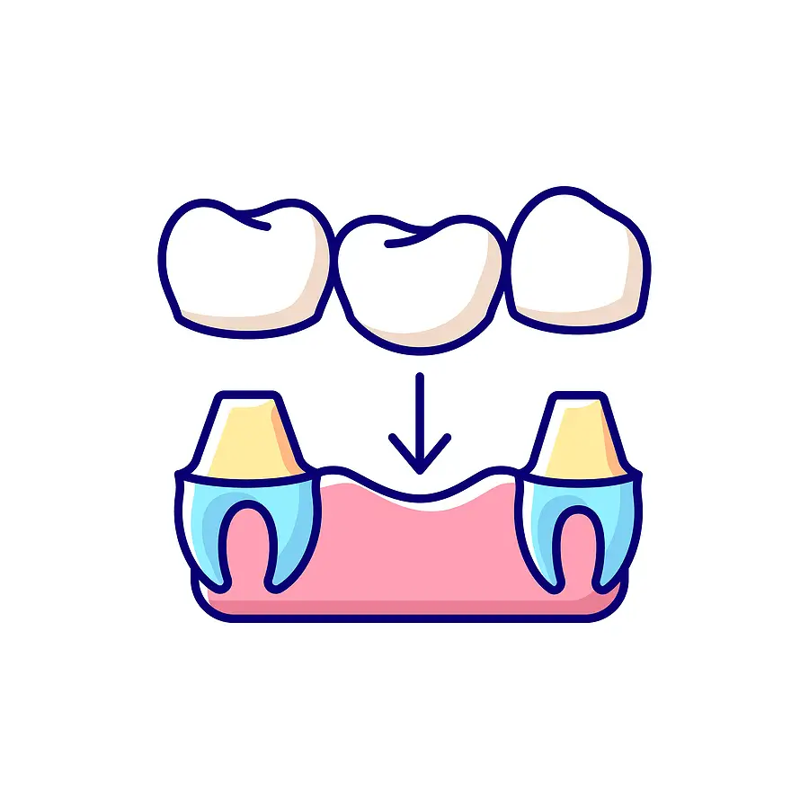 Crowns & Bridges Crowns & Bridges